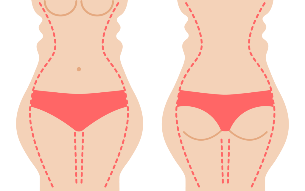 Managing pain and swelling after body contouring surgery diagram